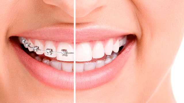 Auxiliar dental