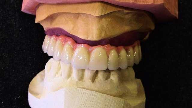 Protésico Dental