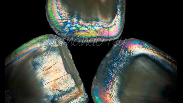 tecnico protesis dental