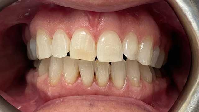 TRAINEE DENTAL NURSE and – FULL TRAINING PROVIDED