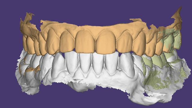Dental Prosthetist