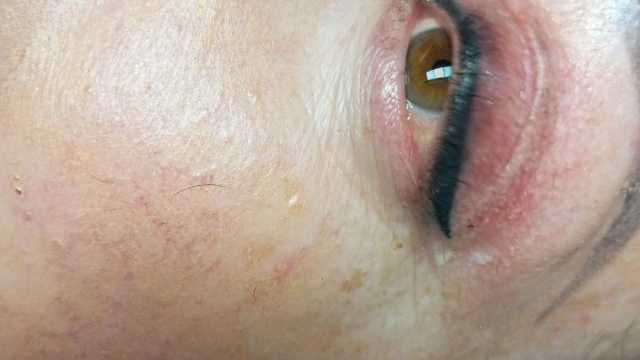 Esteticista