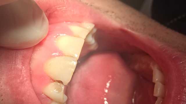 Auxiliar de clinica dental o higienista