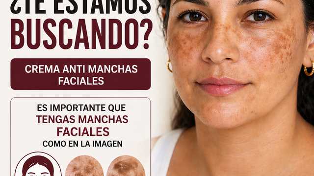 Mujeres con melasma para estudio cosmetico