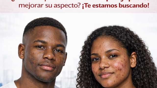 Testadores AFRO con acné o manchas para estudios cosmeticos