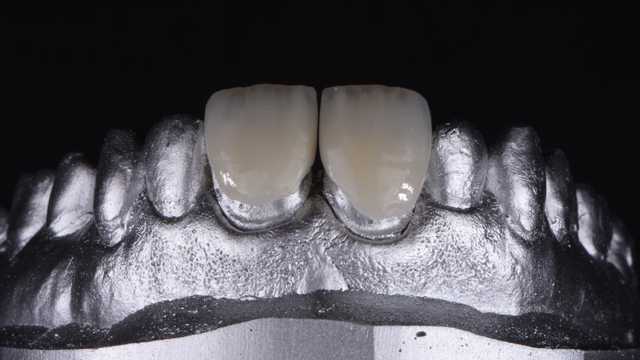 TECNICO DENTAL