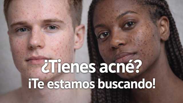 Testadores con acné para estudios cosmeticos